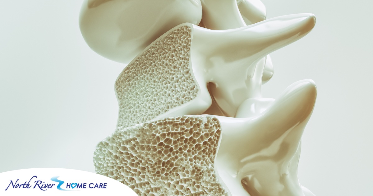 An image of a spine with the inside exposed represents osteoporosis.